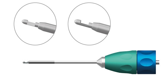 TMV191 TRABECULECTOMY  RUNCH